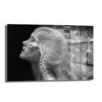 Zihin Akışı: Modern Beyin ve İnsan Anatomisi Cam Tablo Duvar Dekoru Zihin Akışı: Modern Beyin ve İnsan Anatomisi Cam Tablo, siyah fon üzerinde beynin ve omuriliğin estetik X-ray yorumunu sunan, dayanıklı temperli camdan yapılmış modern dekoratif bir duvar sanatıdır.